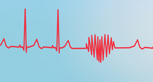 Pulse Article Synapse MBS launch